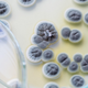 Image for article titled Our Cancers Are Filled With Fungi